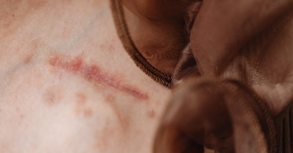 Comment réparer la blessure narcissique : stratégies et conseils découvrez le concept de l'injury narcissique, ses impacts psychologiques et émotionnels sur les individus. apprenez à reconnaître ses signes, comprendre ses conséquences et explorez des pistes de réflexion pour surmonter cette blessure émotionnelle.