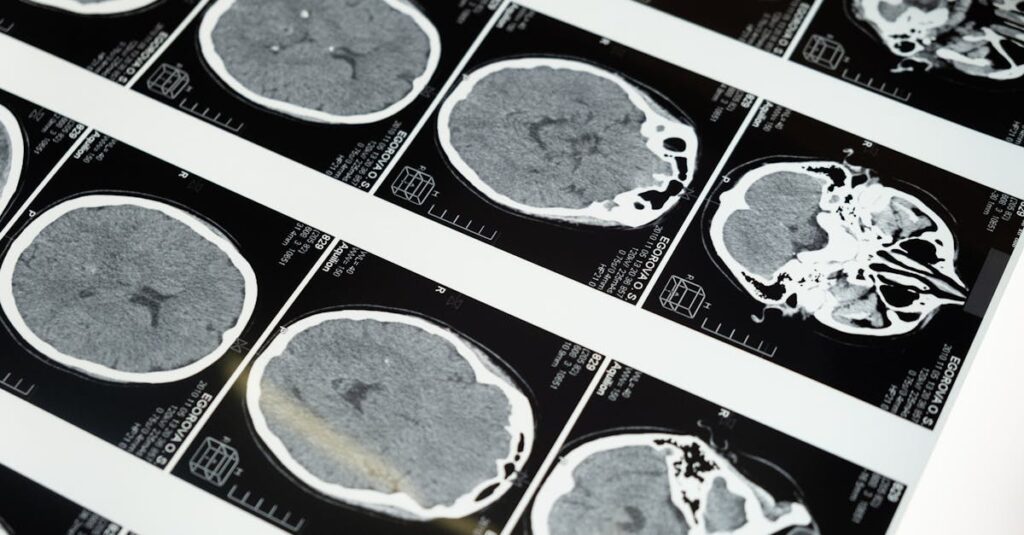 les ventricules cérébraux sont des cavités remplies de liquide céphalorachidien situées dans le cerveau, essentielles pour la protection et le bon fonctionnement du système nerveux central.